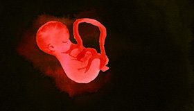 Thumbnail for Les Noeuds du Destin
